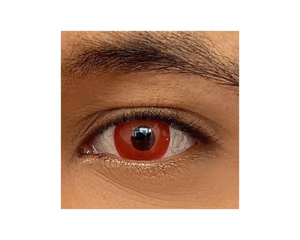Central oftalmica - LIVO